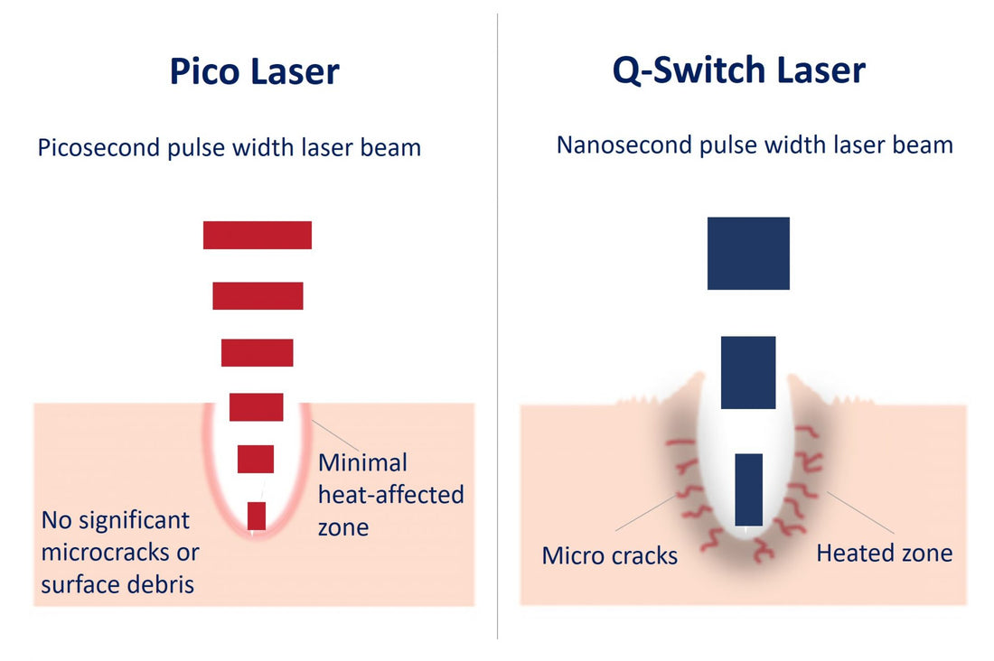 Difference Between Q-switch and Pico-Switch Lasers