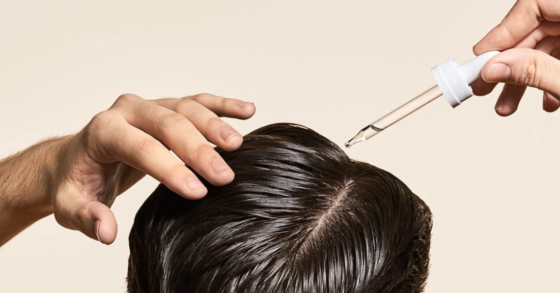 Minoxidil vs Finasteride vs Procapil For Hair Loss