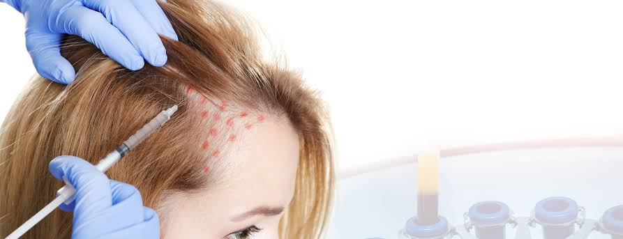 Benefits Of Injecting 2ml vs 4ml PRP / PRF in Scalp For Hair Regrowth