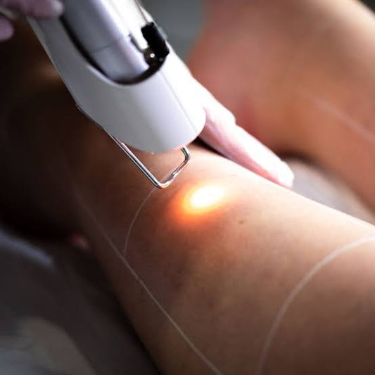 Is laser hair removal permanent, or is it temporary?