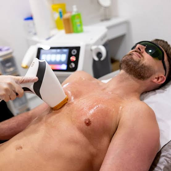 How Does Laser Hair Removal Work, and Is It Safe?