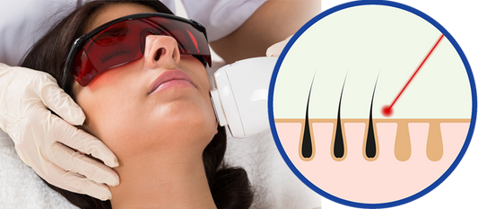 Can I use laser hair removal treatment on my face?