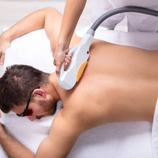 Is laser hair removal effective for heavy hairy men's back?