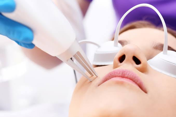 Is laser treatment to treat acne scars really harmful?