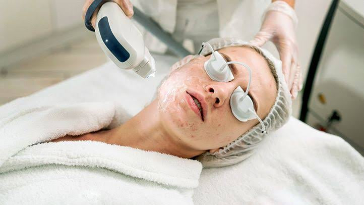 Are facials worth the cost as a way to treat acne scarring?