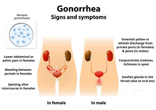 Gonorrhea Treatment Clinic & Cost SKINFUDGE® Clinics (Dermatology, Plastic Surgery & Laser Center)