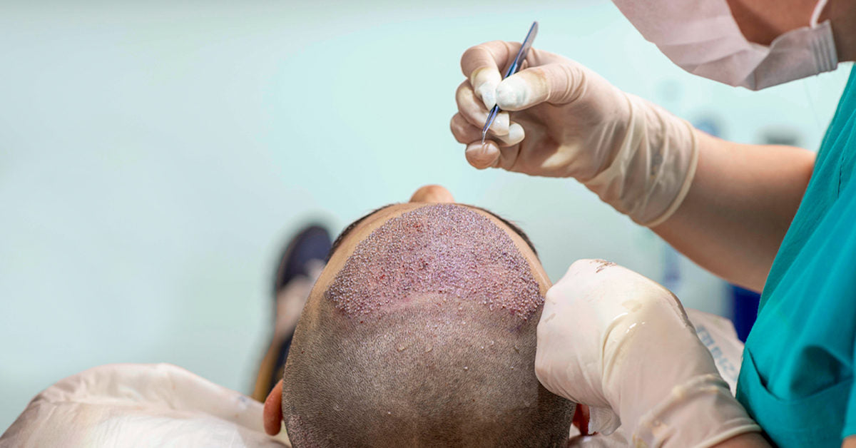 FUE Hair Transplant SKINFUDGE® Clinics (Dermatology, Plastic Surgery & Laser Center)