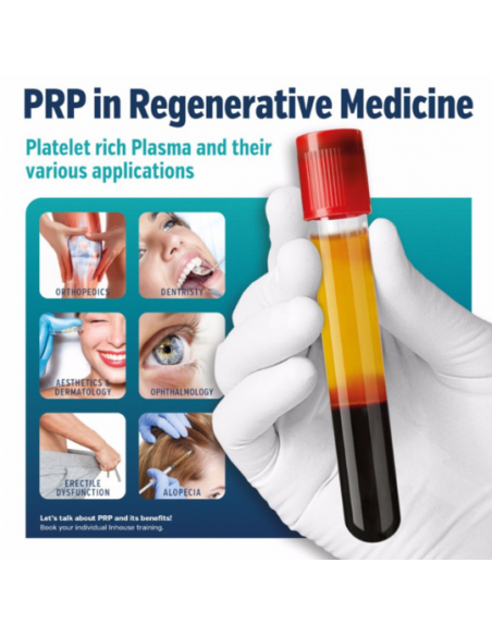 PRP Tube with Sodium Citrate 10mL SKINFUDGE® Clinic Lahore (Dermatologist / Skin Specialist)